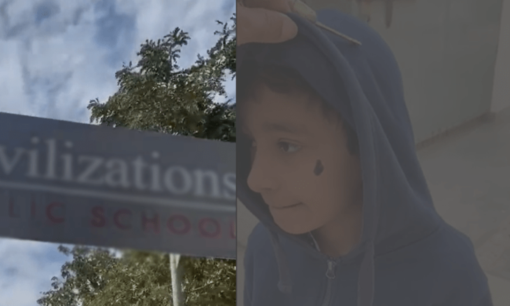 child karachi face